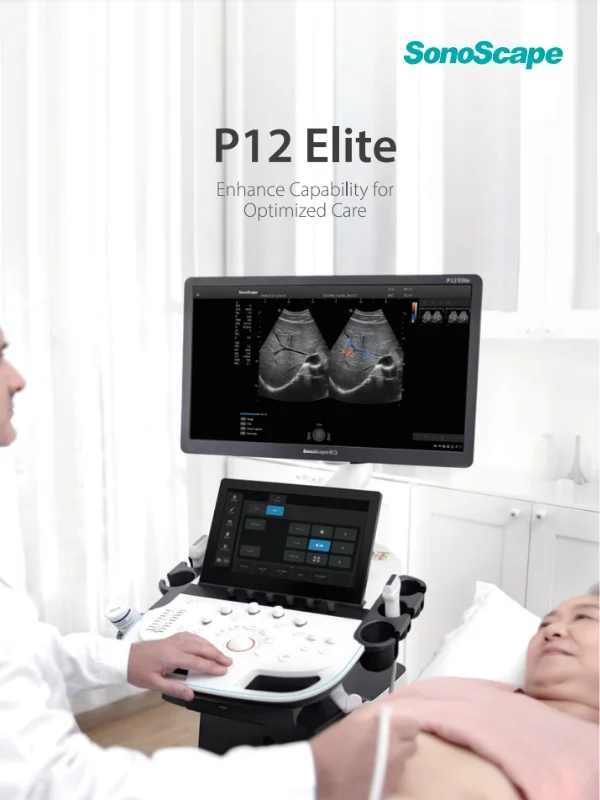 SonoScape P12 Elite Broschüre bei Sonowied
