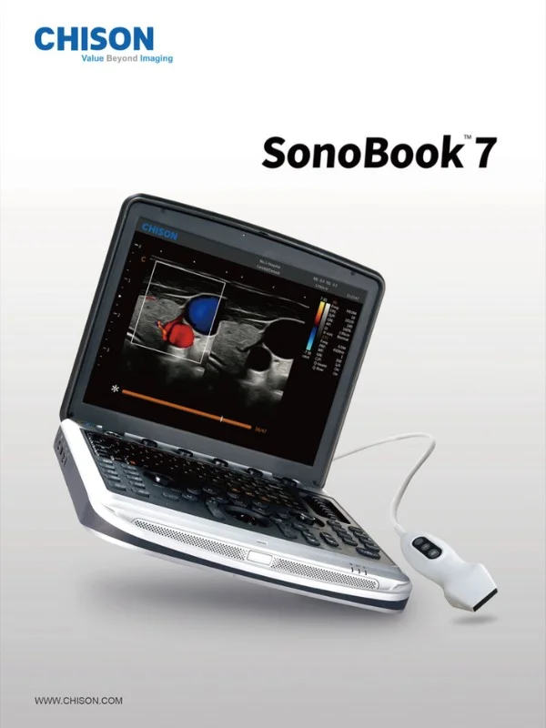 Chison Sonobook 7 bei Sonowied
