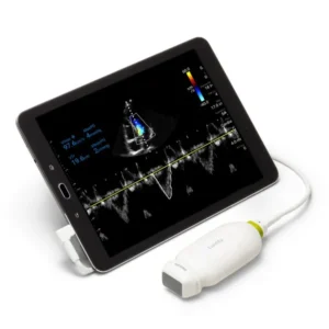Philips Lumify bei Sonowied