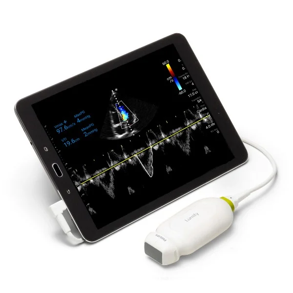 Philips Lumify bei Sonowied