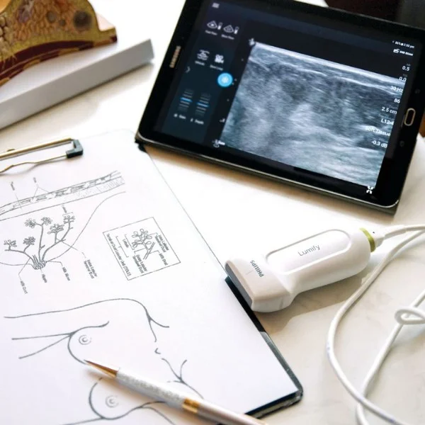 Philips Lumify bei Sonowied
