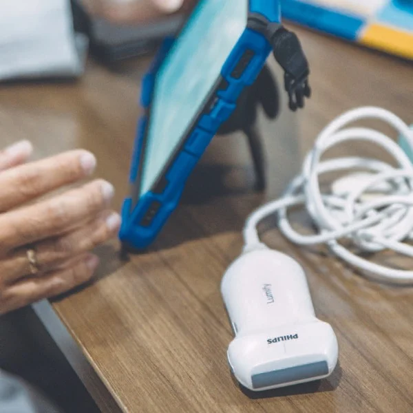 Philips Lumify bei Sonowied