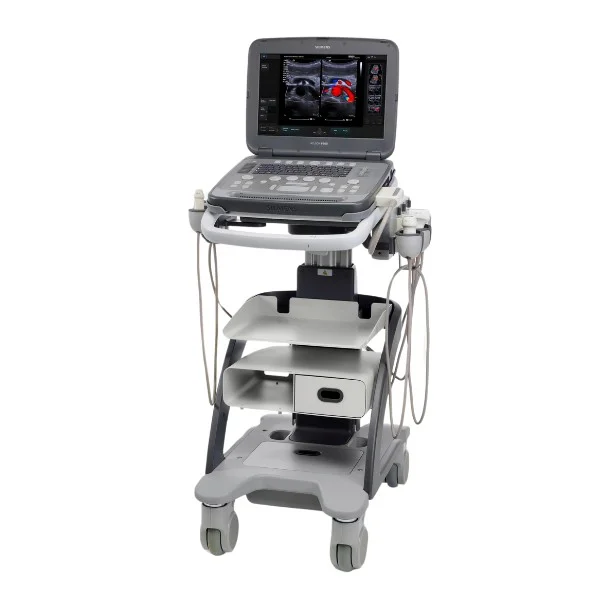 Siemens Acuson P500 bei Sonowied