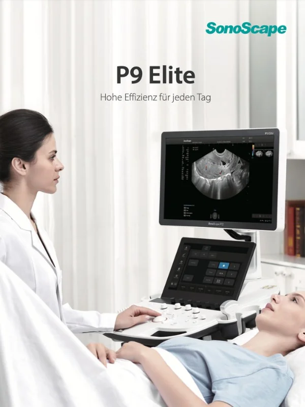 Broschüre für das SonoScape P9 Elite