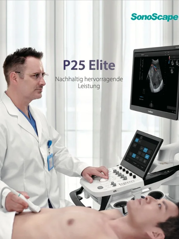 SonoScape P25 Elite Broschüre