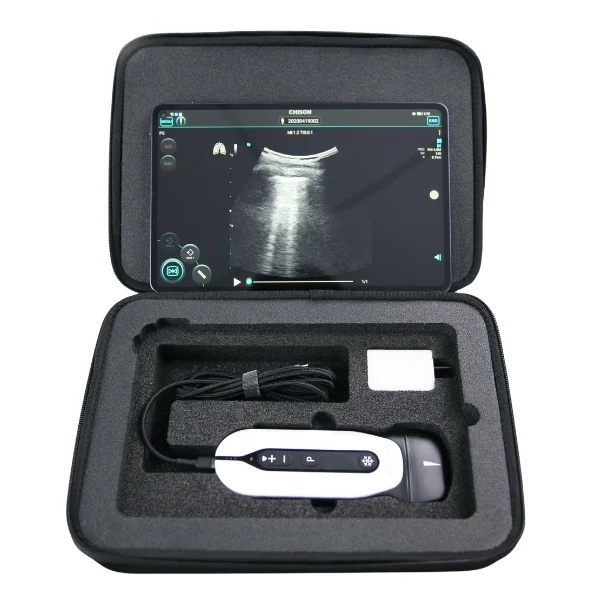 Chison SonoEye bei Sonowied