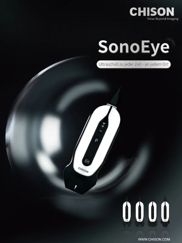 Chison SonoEye Broschüre bei Sonowied
