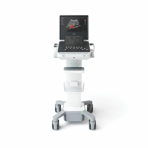 Philips Compact 5500 bei Sonowied