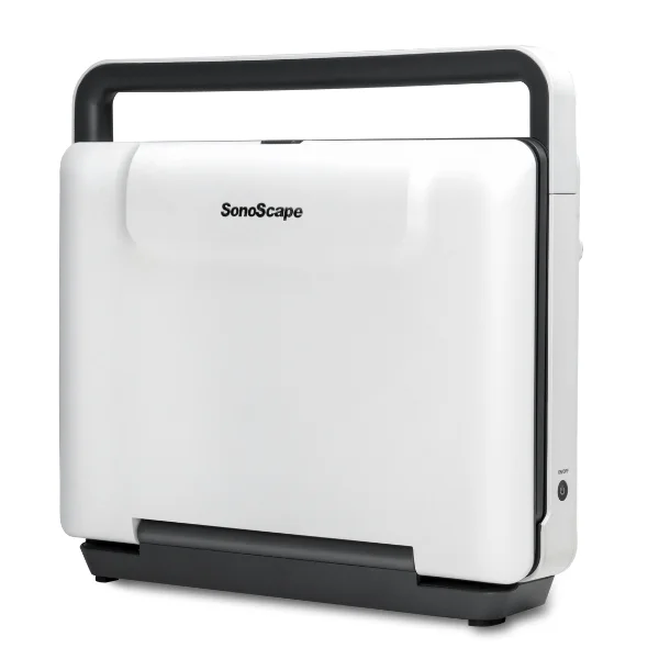 SonoScape E1 Pro bei Sonowied