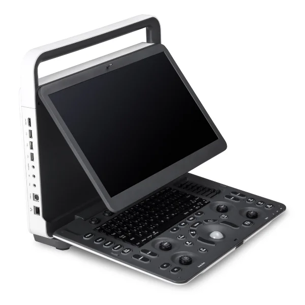 SonoScape E1 Pro bei Sonowied