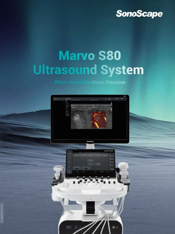Sonoscape S80 Broschüre bei Sonowied