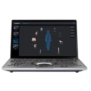 Mobiles Sonographiegerät SonoAir 70 von Chison bei Sonowied
