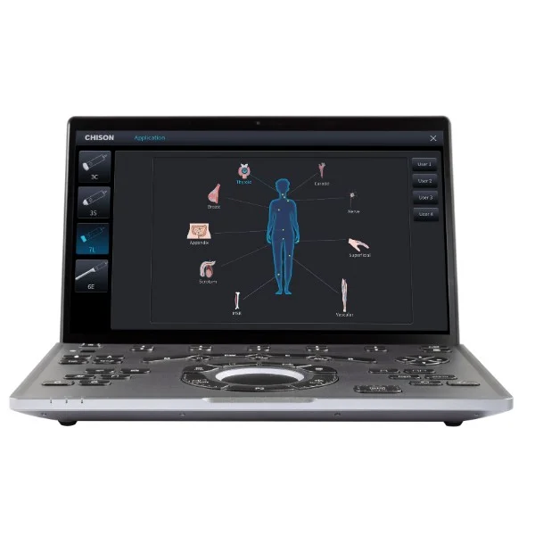 Mobiles Sonographiegerät SonoAir 70 von Chison bei Sonowied